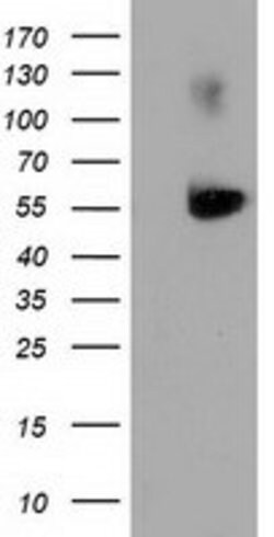 SQSTM1 Mouse anti-Human, Clone: OTI5A2, lyophilized, TrueMAB 100 &mu;g;