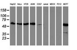 SQSTM1 Mouse anti-Human, Clone: OTI5A2, lyophilized, TrueMAB 100 &mu;g;