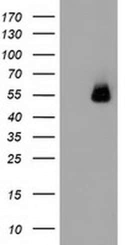 SQSTM1 Monoclonal Antibody (OTI4G9), TrueMAB , OriGene 30 &mu;L | Buy Online | OriGene | Fisher Scientific