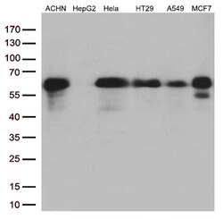 SQSTM1 Mouse anti-Human, Clone: OTI4G9, lyophilized, TrueMAB 100 &mu;g | Buy Online | Origene Technologies | Fisher Scientific