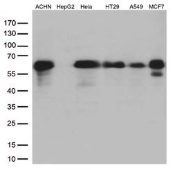 SQSTM1 Monoclonal Antibody (OTI4G9), TrueMAB , OriGene 30 &mu;L | Buy Online | OriGene | Fisher Scientific