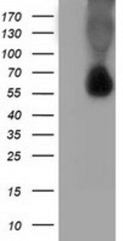 SQSTM1 Mouse anti-Human, Clone: OTI4C8, lyophilized, TrueMAB 100 &mu;g;
