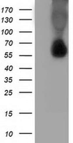 SQSTM1 Monoclonal Antibody (OTI4C8), TrueMAB , OriGene 100 &mu;L; Unconjugated:Antibodies,