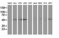 SQSTM1 Mouse anti-Human, Clone: OTI4C8, lyophilized, TrueMAB 100 &mu;g;
