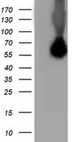 SQSTM1 Monoclonal Antibody (OTI7F6), TrueMAB , OriGene 100 &mu;L; Unconjugated:Antibodies,