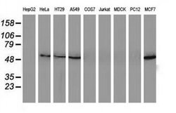 SQSTM1 Monoclonal Antibody (OTI7F6), TrueMAB , OriGene 100 &mu;L; Unconjugated:Antibodies,