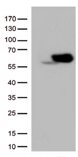 SQSTM1 Monoclonal Antibody (OTI1B2), TrueMAB , OriGene:Antibodies:Primary
