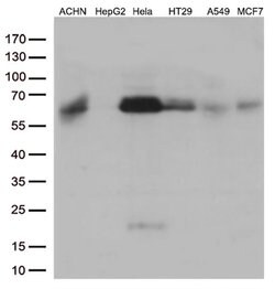 SQSTM1 Monoclonal Antibody (OTI1B2), TrueMAB , OriGene 100 &mu;L; Unconjugated:Antibodies,