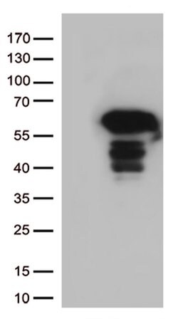 SQSTM1 Monoclonal Antibody (OTI6A7), TrueMAB , OriGene 100 &mu;L; Unconjugated:Antibodies,