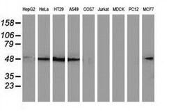 SQSTM1 Monoclonal Antibody (OTI6A7), TrueMAB , OriGene 100 &mu;L; Unconjugated:Antibodies,