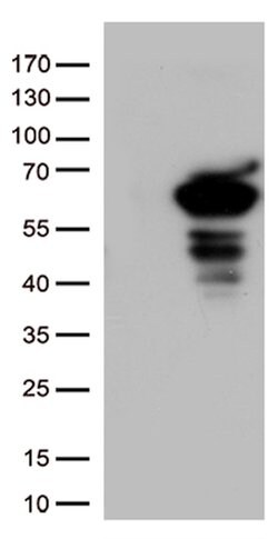 SQSTM1 Mouse anti-Human, Clone: UMAB13, liquid, UltraMAB 30 &mu;L | Buy Online | Origene Technologies | Fisher Scientific