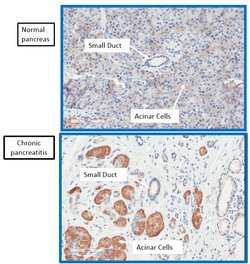 Invitrogen SR140 Polyclonal Antibody 100 &mu;L | Buy Online | Invitrogen&trade; | Fisher Scientific