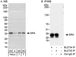 SRA Rabbit anti-Human, Polyclonal, Bethyl Laboratories 100 &mu;L; Unconjugated:Antibodies,