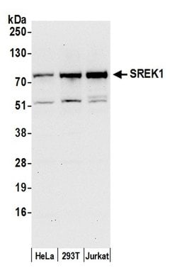 SREK1/SFRS12 Polyclonal Antibody, Bethyl Laboratories 20 μL; Unconjugated:Antibodies,