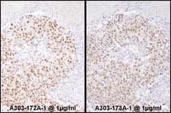 SRF Rabbit anti-Human, Polyclonal, Bethyl Laboratories 100 &mu;L; Unconjugated:Antibodies,