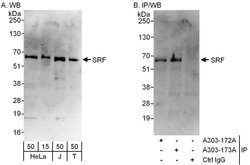 SRF Rabbit anti-Human, Polyclonal, Bethyl Laboratories 100 &mu;L; Unconjugated:Antibodies,