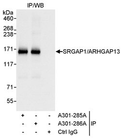 SRGAP1/ARHGAP13 Rabbit anti-Human, Polyclonal, Bethyl Laboratories 10 &mu;L;