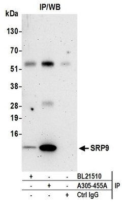 SRP9 Rabbit anti-Human, Polyclonal, Bethyl Laboratories 100 &mu;L; Unconjugated:Antibodies,