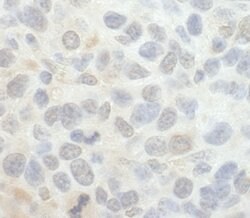 SRPK1 Polyclonal Antibody, Bethyl Laboratories 10 &mu;L | Buy Online | Bethyl Laboratories, Inc | Fisher Scientific