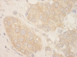 SRPK2 Polyclonal Antibody, Bethyl Laboratories 100 &mu;L; Unconjugated:Antibodies,