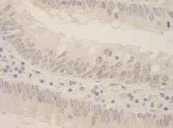 SRPK2 Polyclonal Antibody, Bethyl Laboratories 100 &mu;L; Unconjugated:Antibodies,