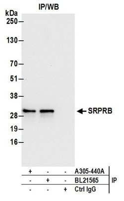 SRPRB Rabbit anti-Human, Mouse, Polyclonal, Bethyl Laboratories 100 &mu;l;