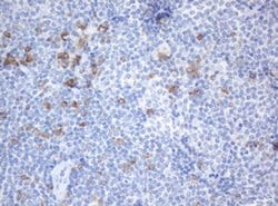 SRPRB Monoclonal Antibody (OTI2B9), TrueMAB , OriGene 30 &mu;L; Unconjugated:Antibodies,