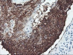 SRPRB Monoclonal Antibody (OTI1D9), TrueMAB , OriGene 100 &mu;L; Unconjugated:Antibodies,