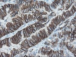 SRPRB Monoclonal Antibody (OTI1D9), TrueMAB , OriGene 100 &mu;L; Unconjugated:Antibodies,