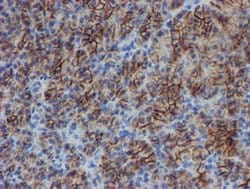 SRPRB Monoclonal Antibody (OTI1D9), TrueMAB , OriGene 100 &mu;L; Unconjugated:Antibodies,