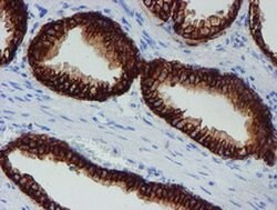 SRPRB Monoclonal Antibody (OTI1D9), TrueMAB , OriGene 100 &mu;L; Unconjugated:Antibodies,