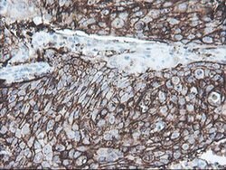 SRPRB Monoclonal Antibody (OTI1D9), TrueMAB , OriGene 100 &mu;L; Unconjugated:Antibodies,