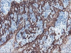 SRPRB Monoclonal Antibody (OTI1D9), TrueMAB , OriGene:Antibodies:Primary