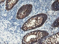 SRPRB Monoclonal Antibody (OTI1D9), TrueMAB , OriGene 100 &mu;L; Unconjugated:Antibodies,