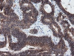 SRPRB Monoclonal Antibody (OTI1D9), TrueMAB , OriGene 100 &mu;L; Unconjugated:Antibodies,