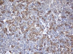 SRPRB Monoclonal Antibody (OTI3E6), TrueMAB , OriGene:Antibodies:Primary