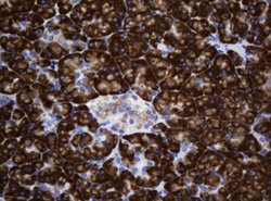 SRPRB Mouse anti-Human, Clone: OTI2D4, lyophilized, TrueMAB 100 &mu;g;