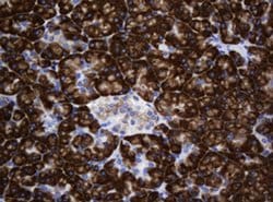 SRPRB Monoclonal Antibody (OTI2D4), TrueMAB , OriGene 100 &mu;L; Unconjugated:Antibodies,