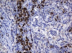 SRPRB Monoclonal Antibody (OTI2D4), TrueMAB , OriGene 100 &mu;L; Unconjugated:Antibodies,