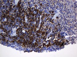 SRPRB Monoclonal Antibody (OTI2D4), TrueMAB , OriGene 100 &mu;L; Unconjugated:Antibodies,