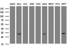 SRPRB Monoclonal Antibody (OTI2B9), TrueMAB , OriGene 30 &mu;L; Unconjugated:Antibodies,