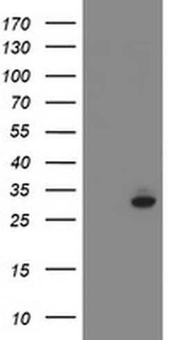 SRPRB Monoclonal Antibody (OTI1D9), TrueMAB , OriGene 100 &mu;L; Unconjugated:Antibodies,