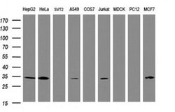SRPRB Monoclonal Antibody (OTI3E6), TrueMAB , OriGene 100 &mu;L; Unconjugated:Antibodies,