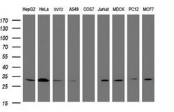 SRPRB Monoclonal Antibody (OTI5G5), TrueMAB , OriGene:Antibodies:Primary