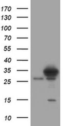 SRPRB Monoclonal Antibody (OTI2D4), TrueMAB , OriGene 100 &mu;L; Unconjugated:Antibodies,