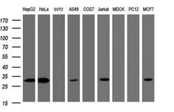 SRPRB Mouse anti-Human, Clone: OTI2D4, lyophilized, TrueMAB 100 &mu;g;