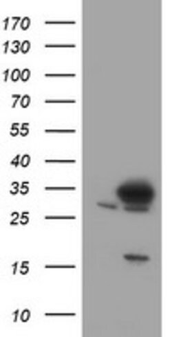 SRPRB Mouse anti-Human, Clone: OTI2D7, lyophilized, TrueMAB 100 &mu;g;