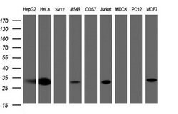 SRPRB Mouse anti-Human, Clone: OTI2D7, lyophilized, TrueMAB 100 &mu;g;