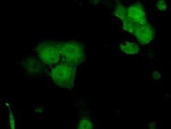 SRR Monoclonal Antibody (OTI7E8), TrueMAB , OriGene 100 &mu;L; Unconjugated:Antibodies,