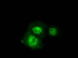 SRR Monoclonal Antibody (OTI3B5), TrueMAB , OriGene 100 &mu;L; Unconjugated:Antibodies,